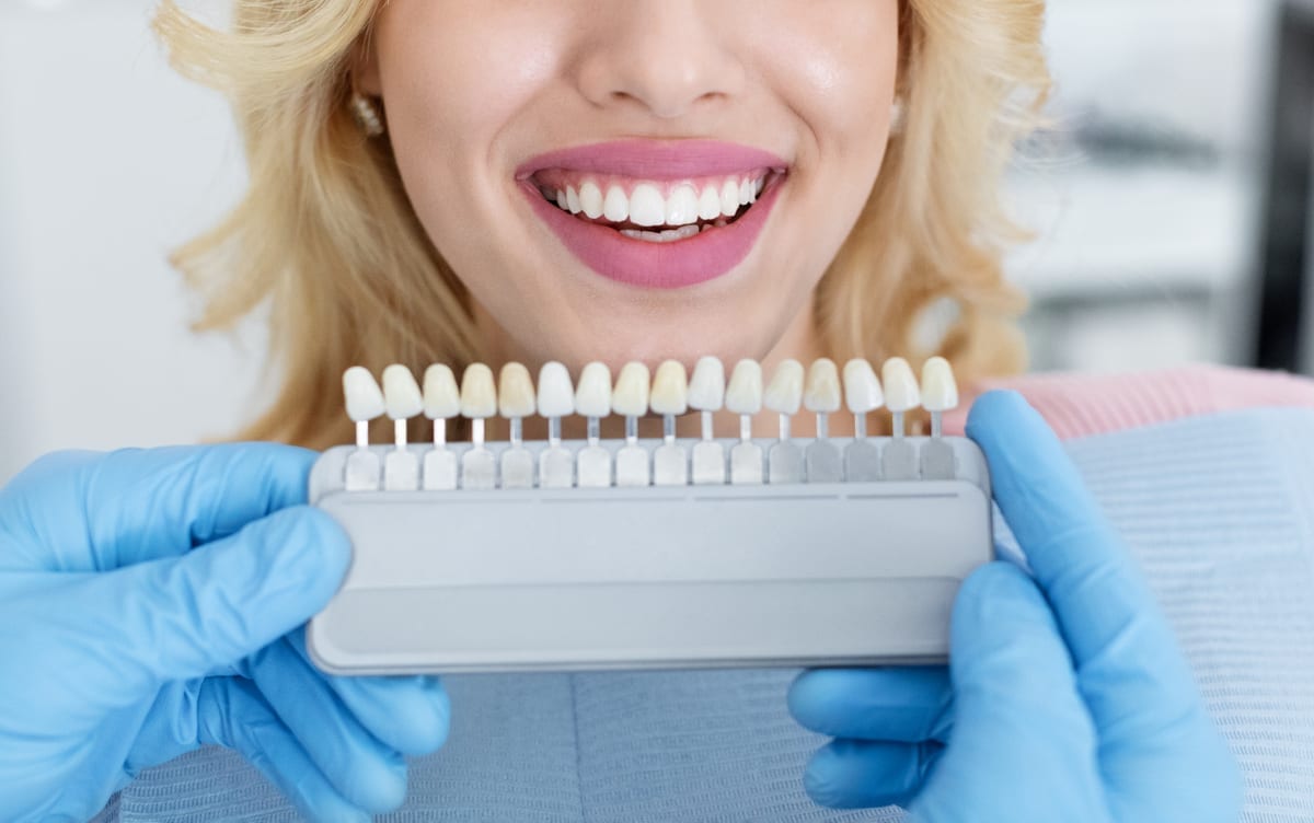 Veneers in Sandston