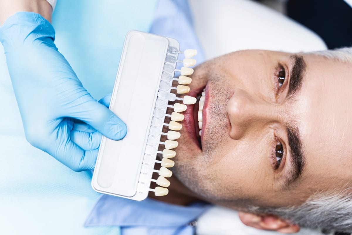 Veneers in Sandston