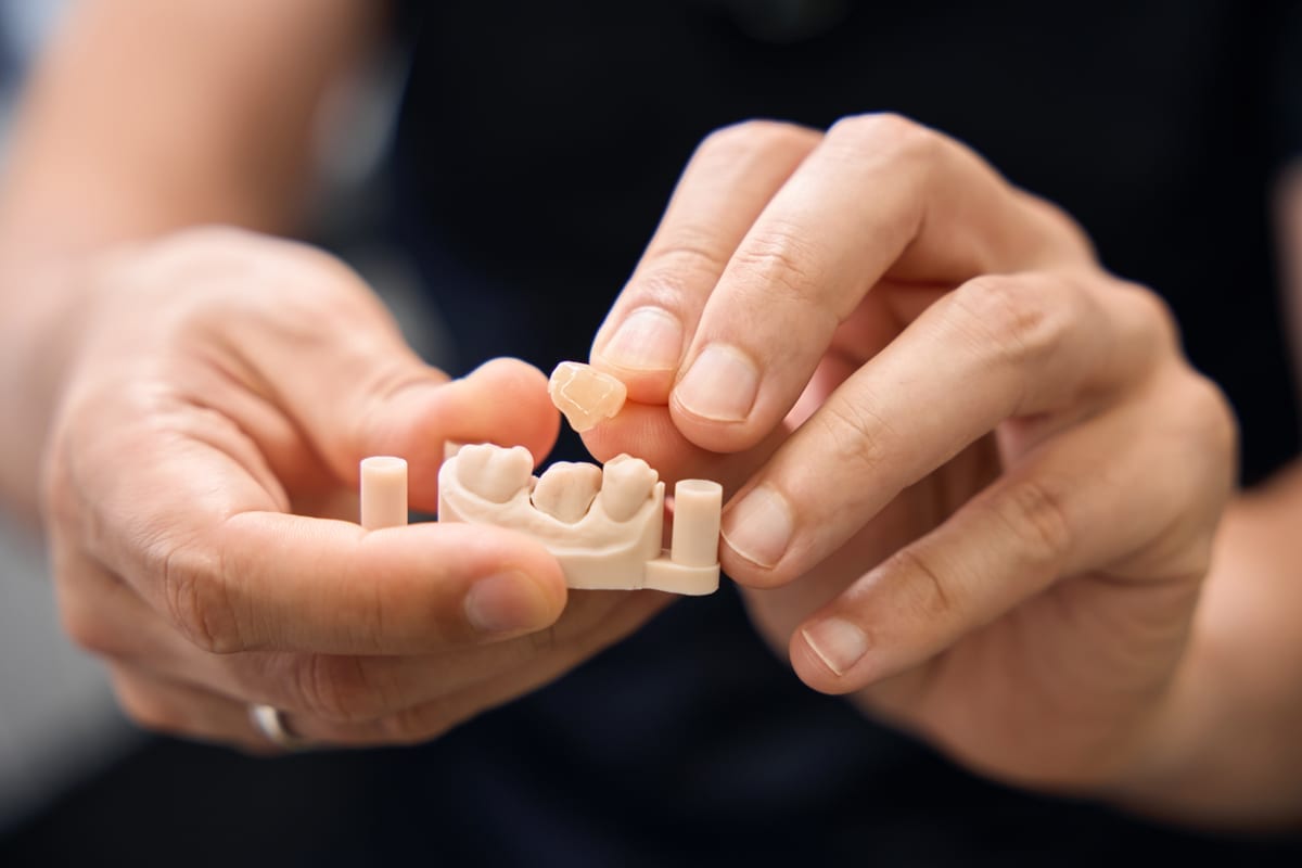 Dental Crowns in Richmond